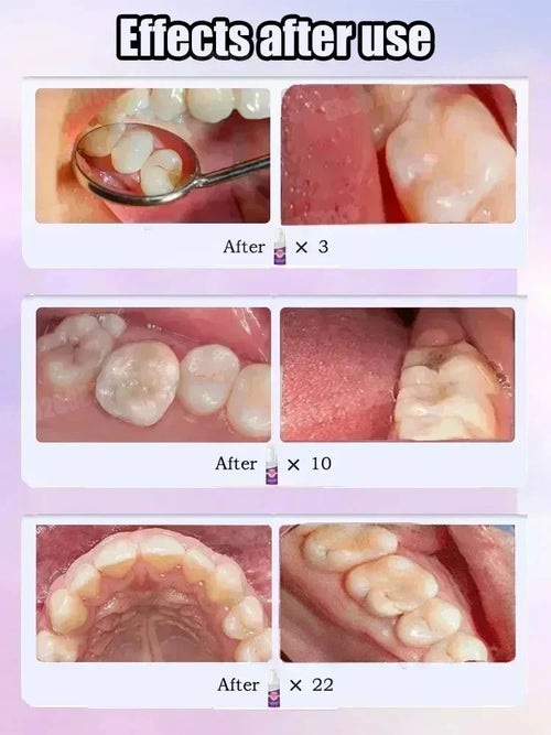 BrightSmile™ Whitening Toothpaste – Brighter Smile, Fresh Breath